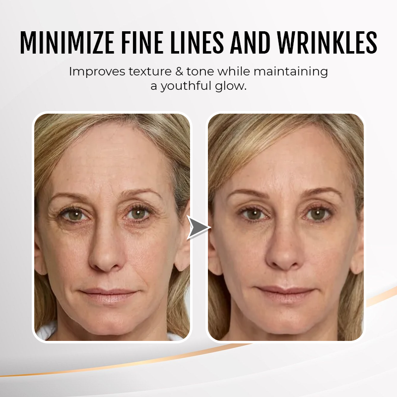 💖Temporary Face Tightener