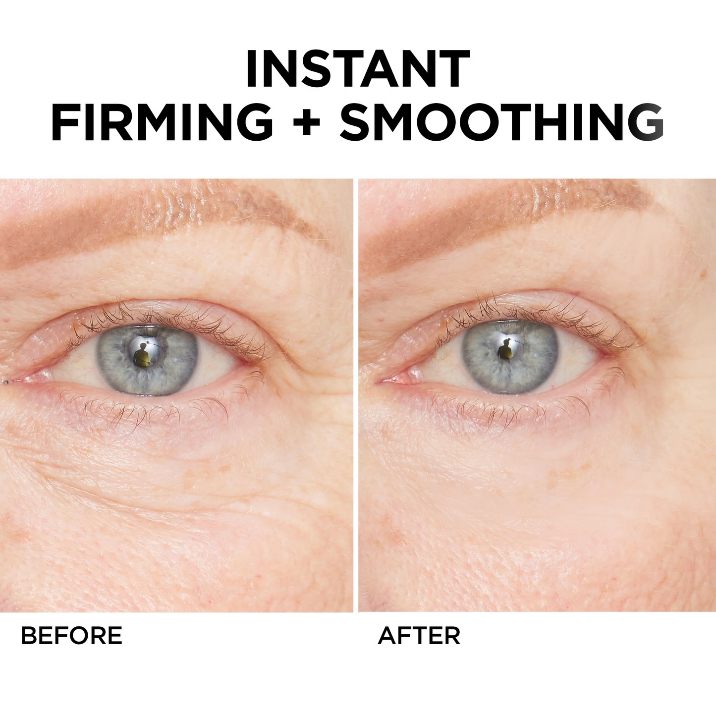 💖Temporary Face Tightener