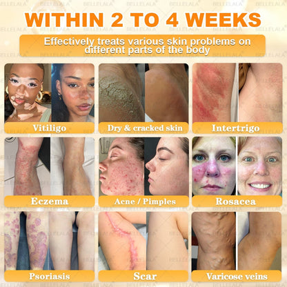 NEW & IMPROVED ✨Bellelala® 𝖡𝖾𝖾 𝗏𝖾𝗇𝗈𝗆 𝖲𝗄𝗂𝗇 𝖱𝖾𝗌𝗍𝗈𝗋𝖺𝗍𝗂𝗈𝗇 𝖢𝗋𝖾𝖺𝗆