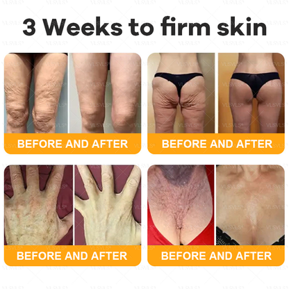 VLSVLS® Bee Venom Comprehensive Cream  👩‍⚕️⏰ LAST DAY 80% OFF (Sagging Skin, Fine Lines, Loss of Firmness, Flat Bust, Drooping Hips, and More)