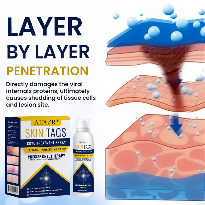 AEXZR® Skin Tag Cryo Treatment Spray🧊 Precision Cryo-Tech: Freezes Away Skin Tags & Warts in Seconds – No Blades, No Pain.